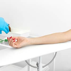 therapeutic-phlebotomy-bloodletting