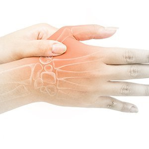 arthritis-symptoms